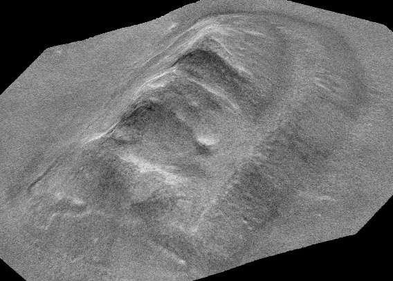 A Closer Look at the First Mars Global Surveyor Images of Cydonia